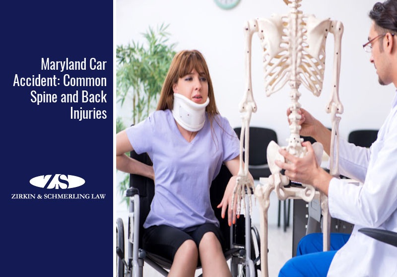 Maryland Car Accident: Common Spine and Back Injuries