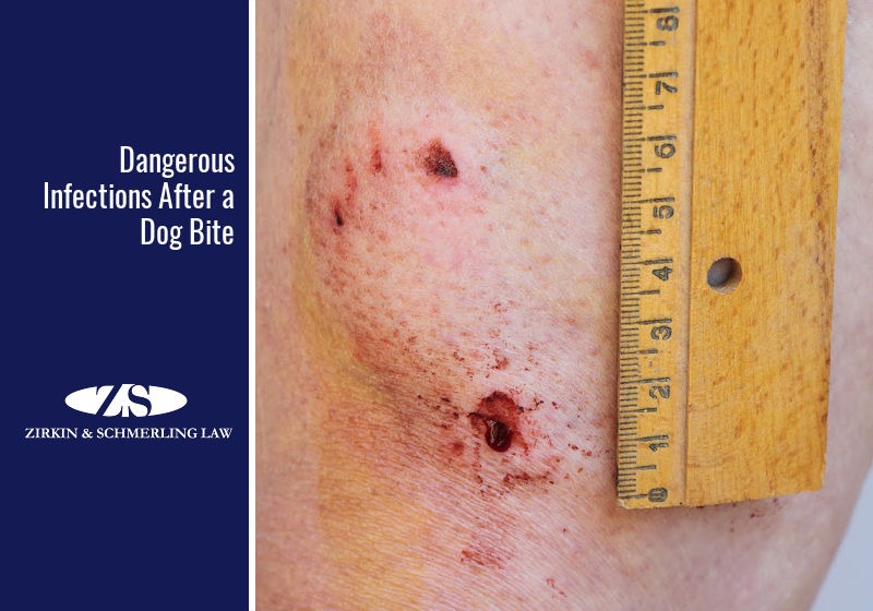 Dangerous Infections After a Dog Bite